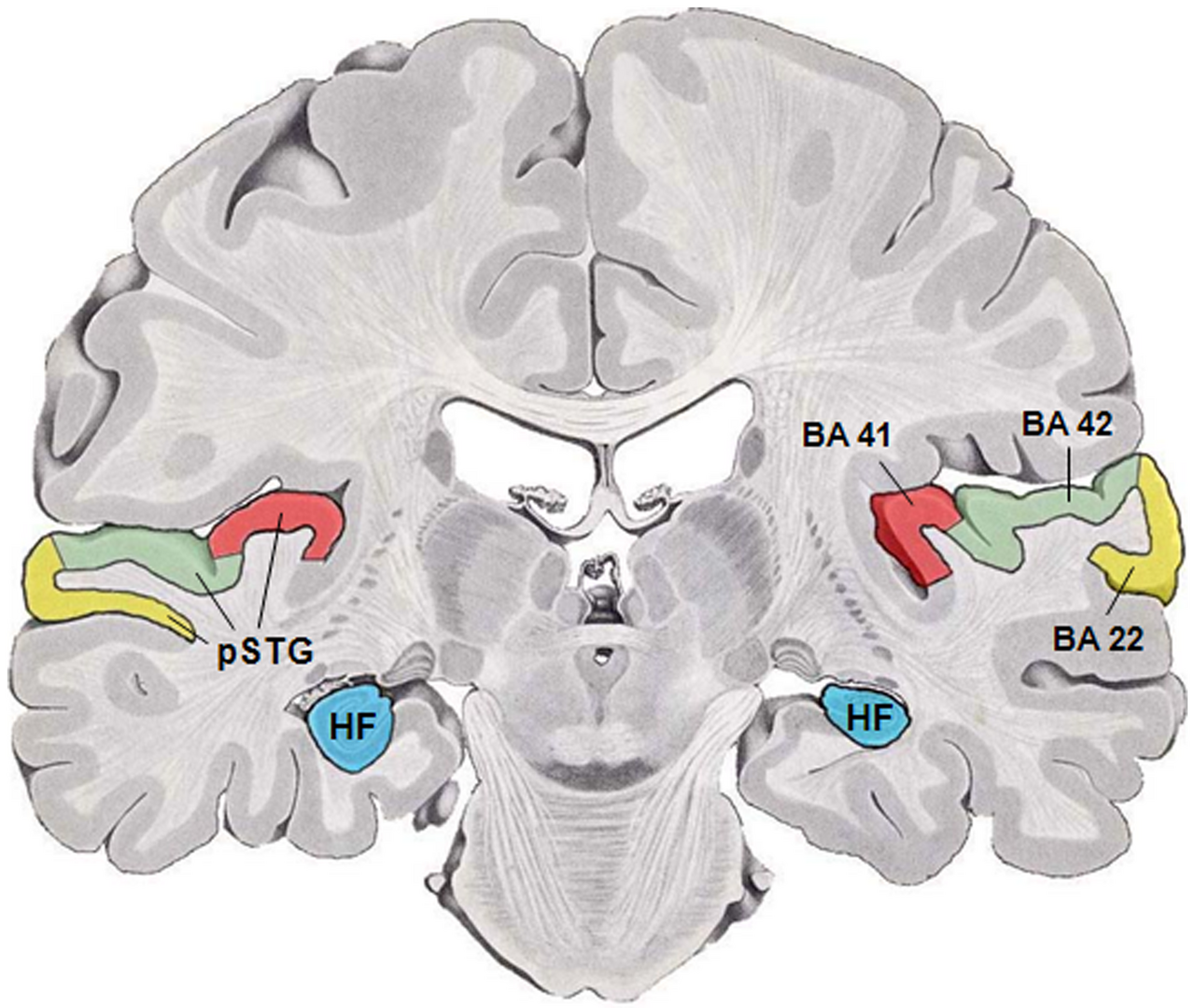 What Causes Déjà Vu? What Neuroscience Says Happens in the Brain
